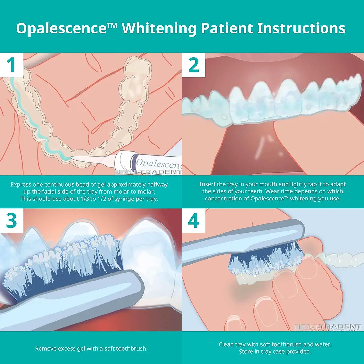 Opalescence gel aplicado en alineador Invisalign, uso compatible y práctico