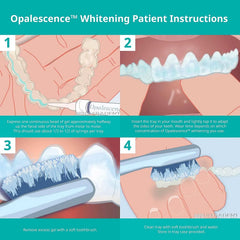 Opalescence gel aplicado en alineador Invisalign, uso compatible y práctico