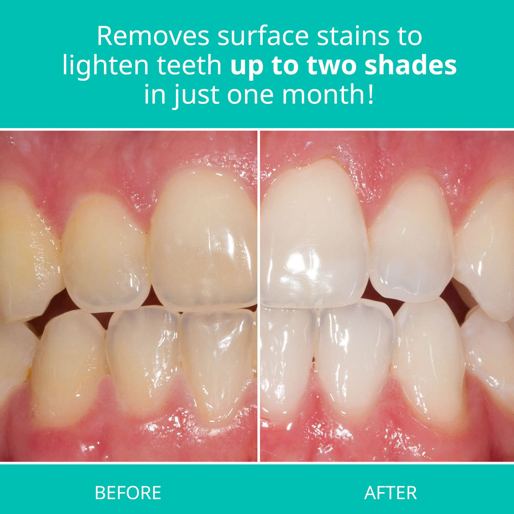 Opalescence en entorno de baño mostrando uso diario y sensación fresca tras cepillado