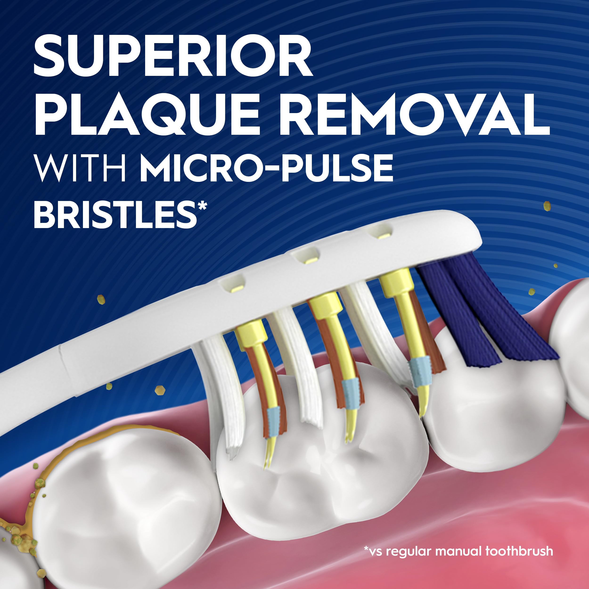 Oral-B Pulsar detalle de cerdas vibrantes que ayudan a aflojar la placa