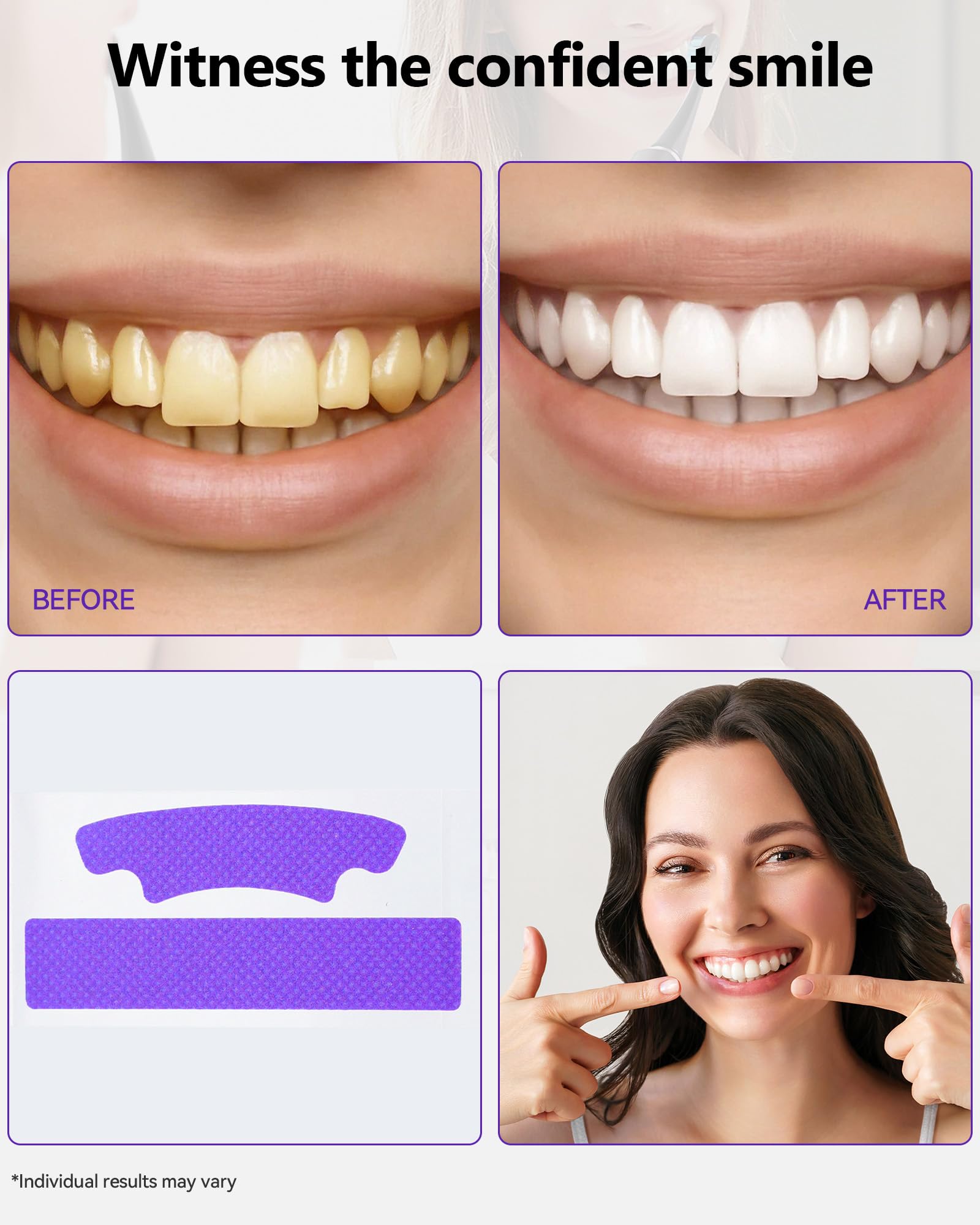 Orrhomi tiras aplicadas en dientes mostrando ajuste cómodo y corrección de color