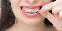 Orthomechanic Orthowax aplicado en brackets para reducir rozaduras y aumentar confort