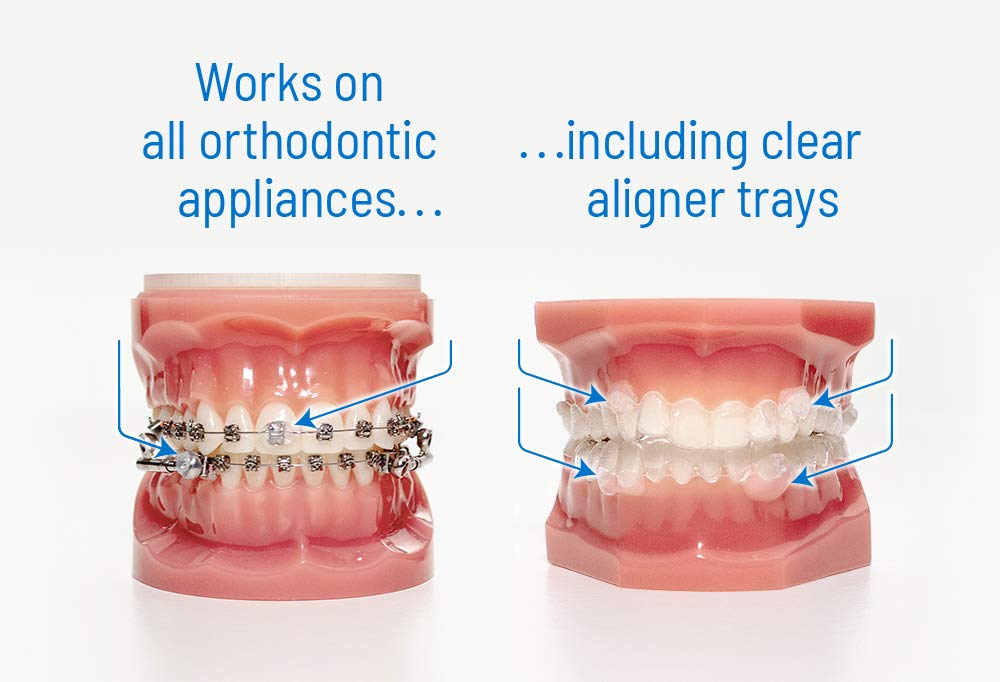 ORVANCE parche OrthoDots aplicado en un bracket, reduce irritación visible