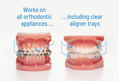 ORVANCE parche OrthoDots aplicado en un bracket, reduce irritación visible