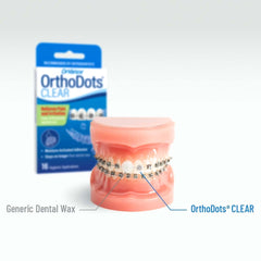 ORVANCE OrthoDots CLEAR aplicado en borde de alineador transparente, discreción estética