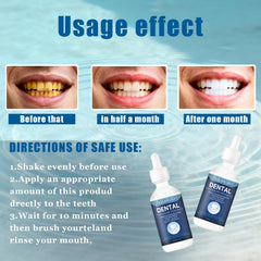 OUHENGTEK sonrisa con dientes sanos sugeriendo soporte al esmalte