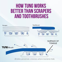Peak Essentials TUNG Brush con tapas protectoras, listo para viajar