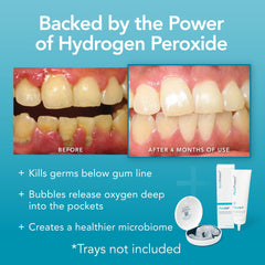 Perio Protect resultado en sonrisa, blanqueamiento gradual sin sensibilidad notable