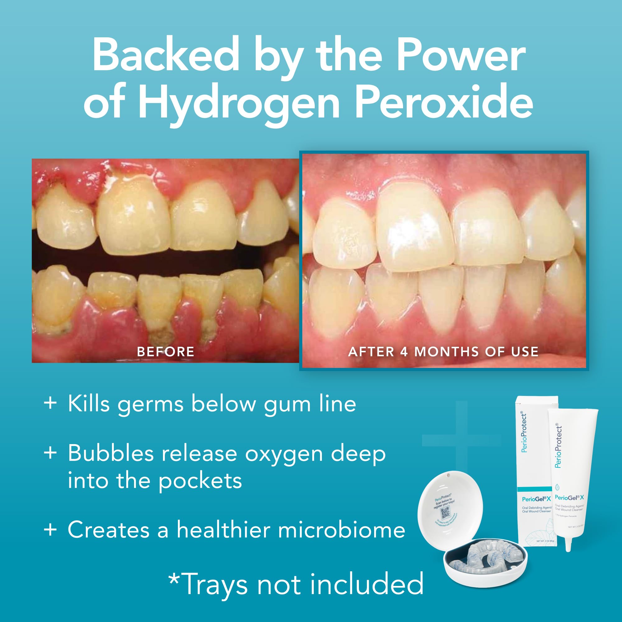 Perio Protect PerioGelX en rutina diaria de baño complementando higiene