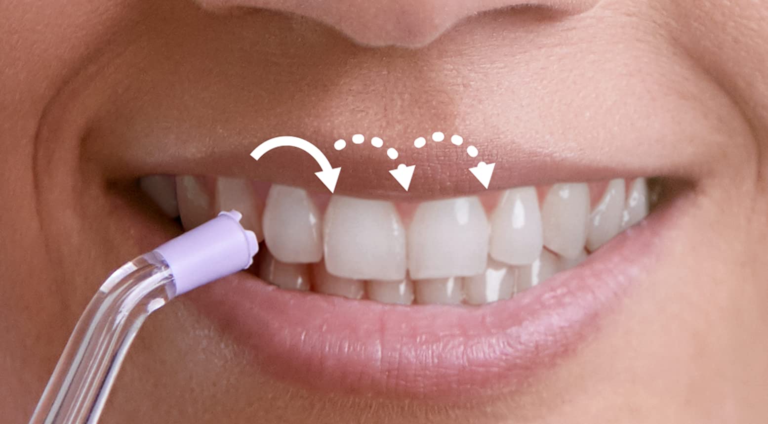 Philips Sonicare imagen del ángulo de los chorros que cubre más superficie interdental
