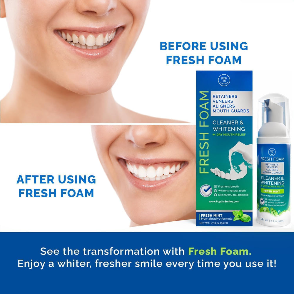 POP ON VENEERS envase 50 ml junto a objetos para comparar tamaño