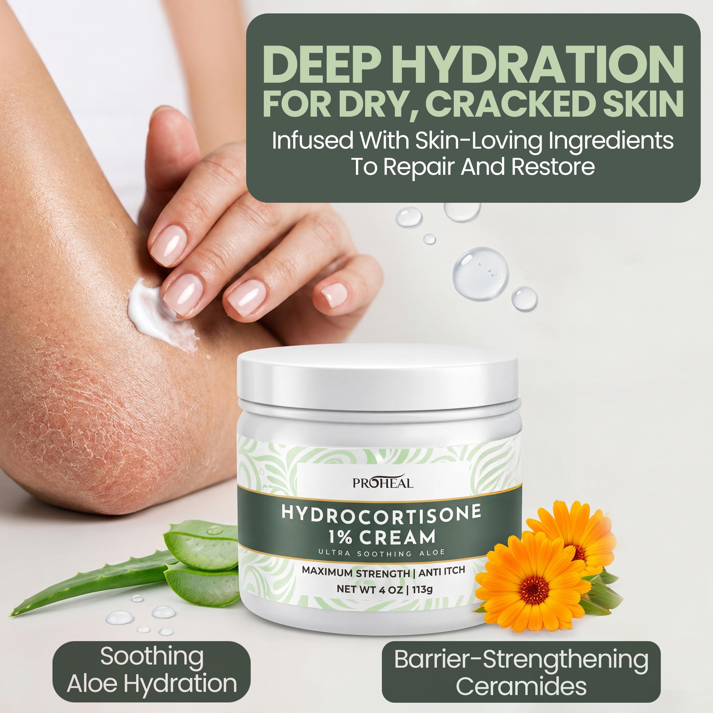 ProHeal persona aplicando la crema en la mano para alivio de picazón inmediato