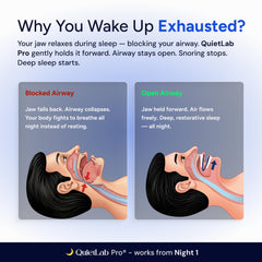 QuietLab detalle del ajuste de avance mandibular para personalización
