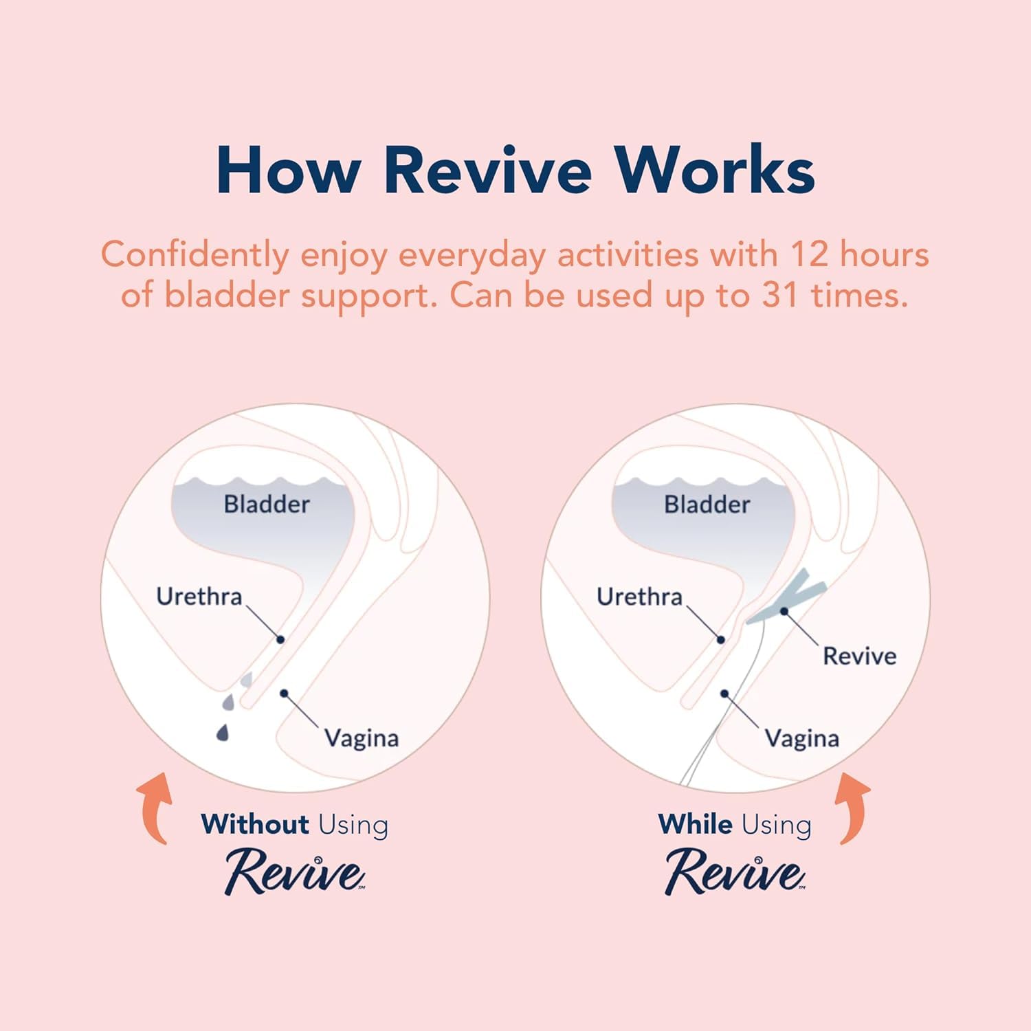 RINOVUM Revive estuche de viaje con dispositivo, aplicador y hilos organizados