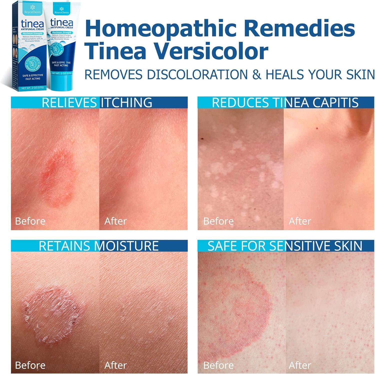 Roycederm crema en mano hidratación visible y absorción efectiva