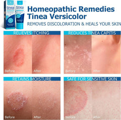 Roycederm crema en mano hidratación visible y absorción efectiva