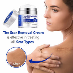 SBHEANGBA botella abierta con gel transparente destacando pureza
