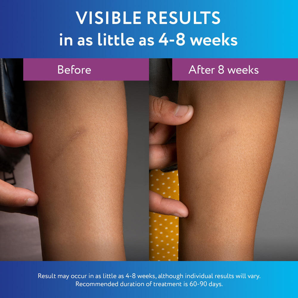 ScarAway etiqueta visible con ingredientes, seguridad y confianza
