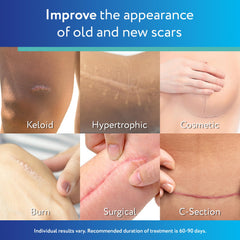 ScarAway tira sostenida en la mano para mostrar tamaño y ajuste práctico