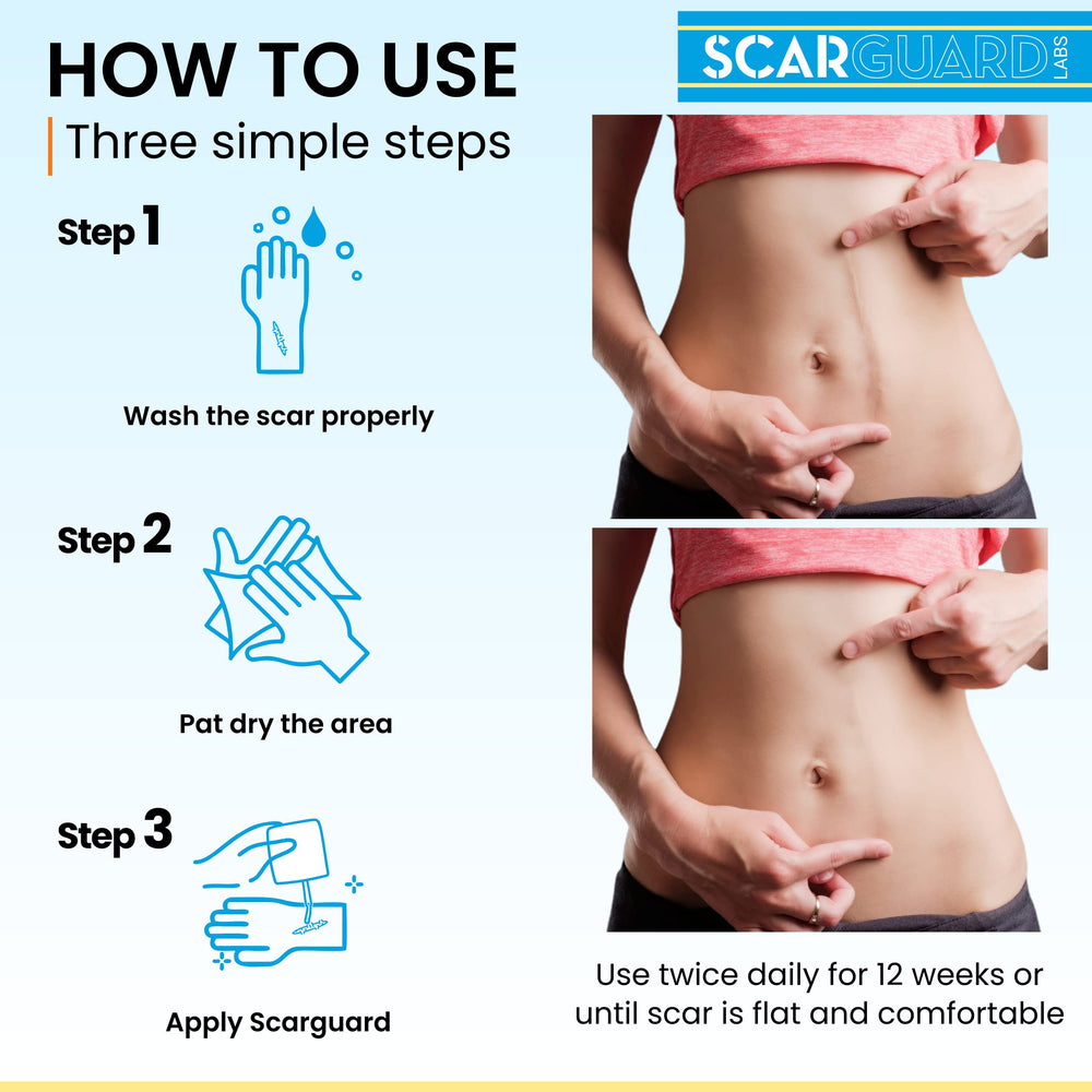 ScarGuard etiqueta con ingredientes destacando vitamina E y silicona