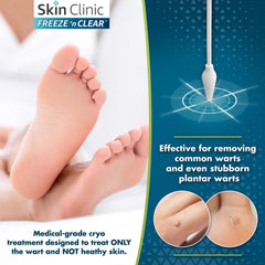 Skin Clinic FREEZE 'n CLEAR comparación de tamaño de aplicadores junto a moneda, escala clara