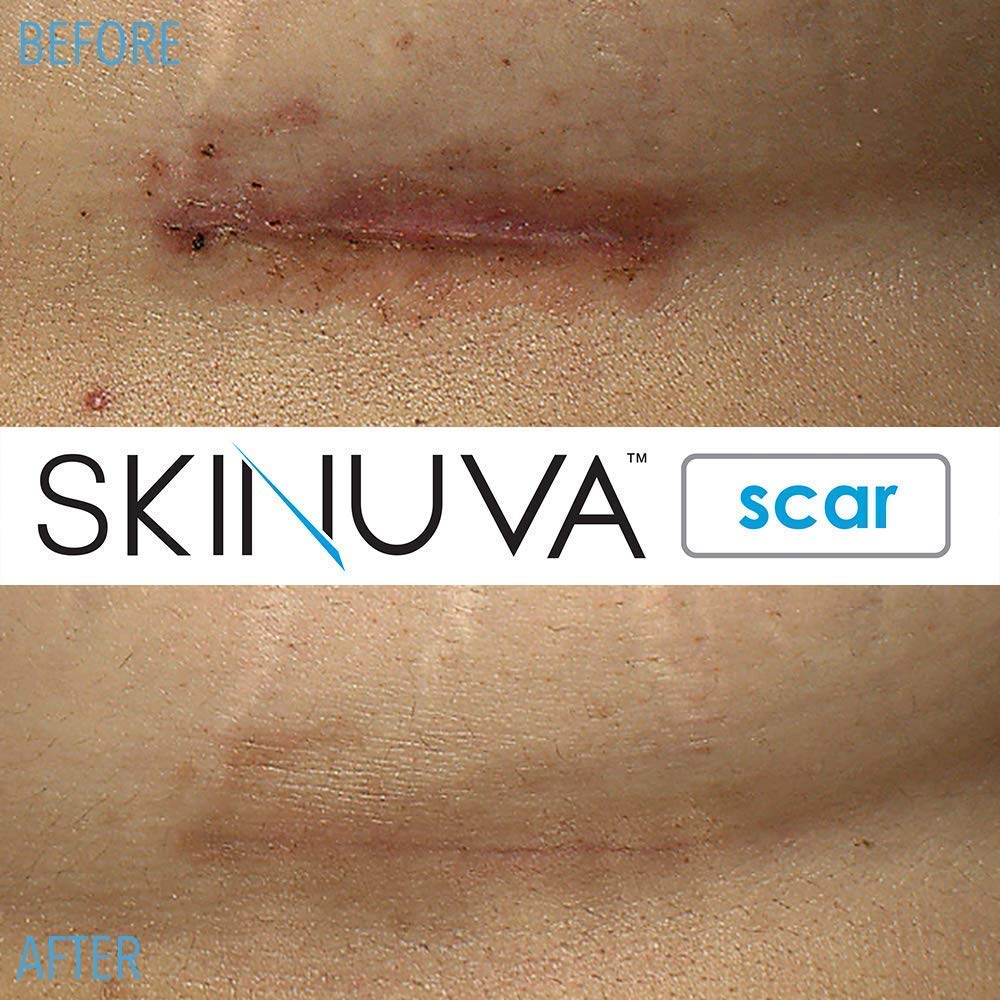 Skinuva tamaño 1 oz comparado con mano para visualizar escala portátil