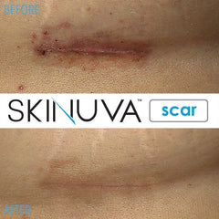 Skinuva tamaño 1 oz comparado con mano para visualizar escala portátil
