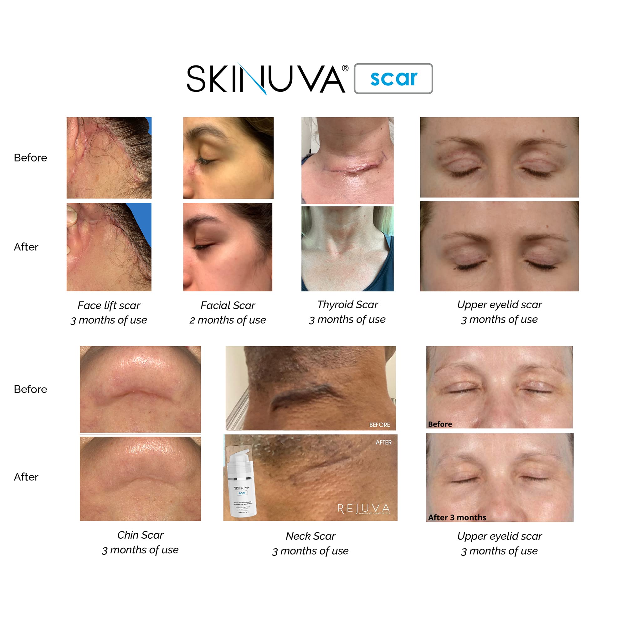 Etiqueta de Skinuva enfocando ingredientes para transparencia y confianza