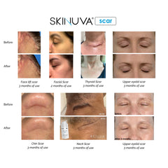 Etiqueta de Skinuva enfocando ingredientes para transparencia y confianza