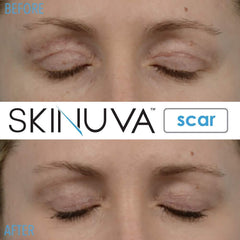 Skinuva producto integrado en rutina diaria para cuidado continuado