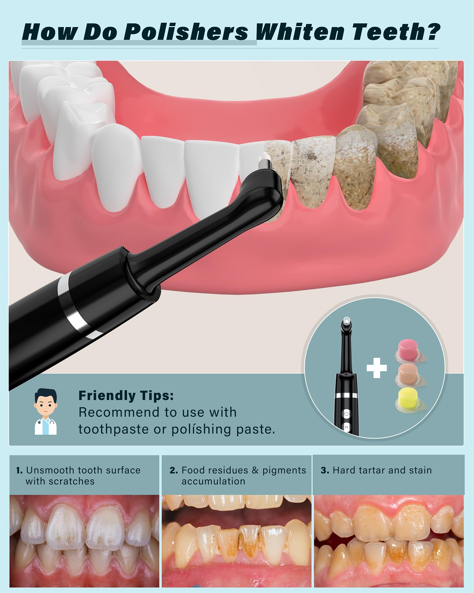 Smile-Aid accesorios completos con cinco cabezales y tres pastas para eficacia