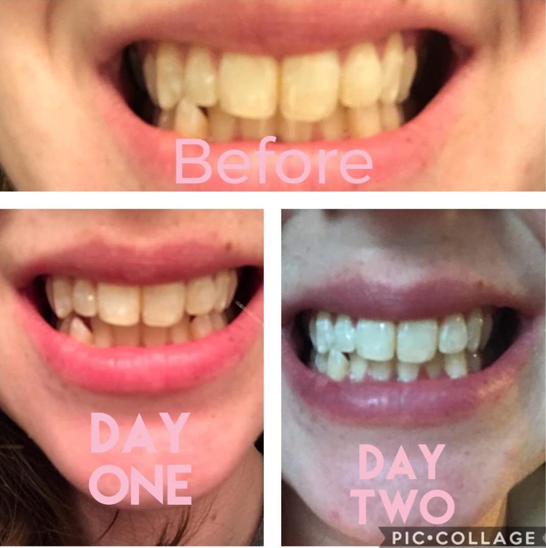Smile Titan textura del gel en primer plano, evidencia consistencia y eficacia