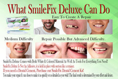 SmileFix perlas termoplásticas en primer plano para moldeado fácil