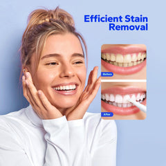 SmileShark aplicador giratorio detalle del pincel para aplicación precisa y sin goteos
