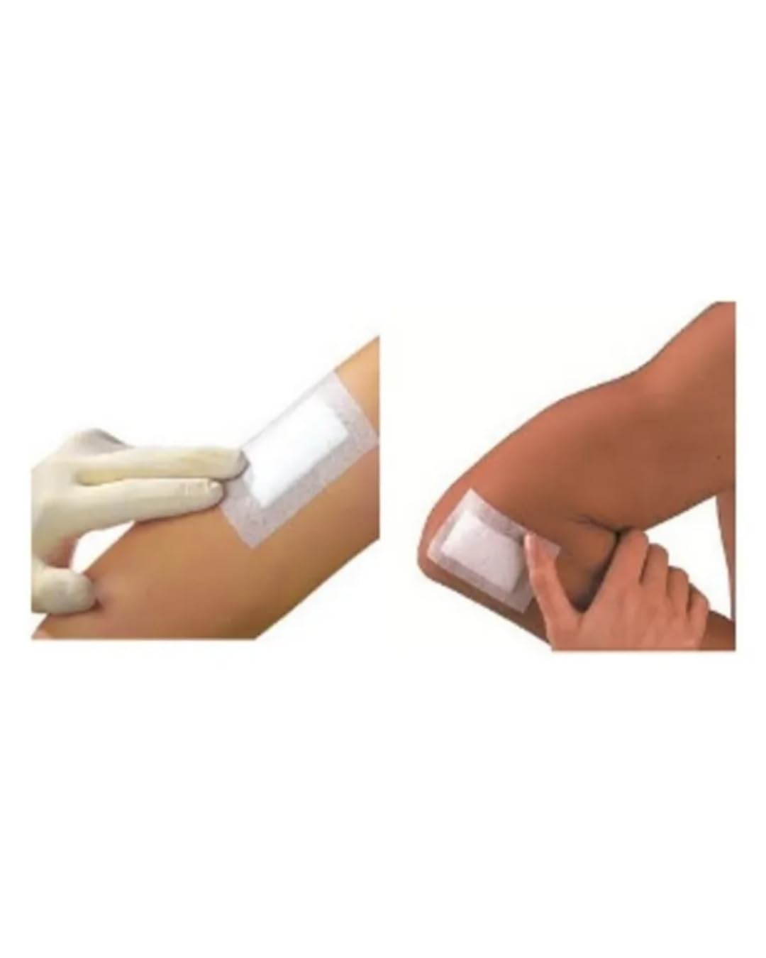 Smith & Nephew Primapore aplicado en codo demostrando conformabilidad y sujeción