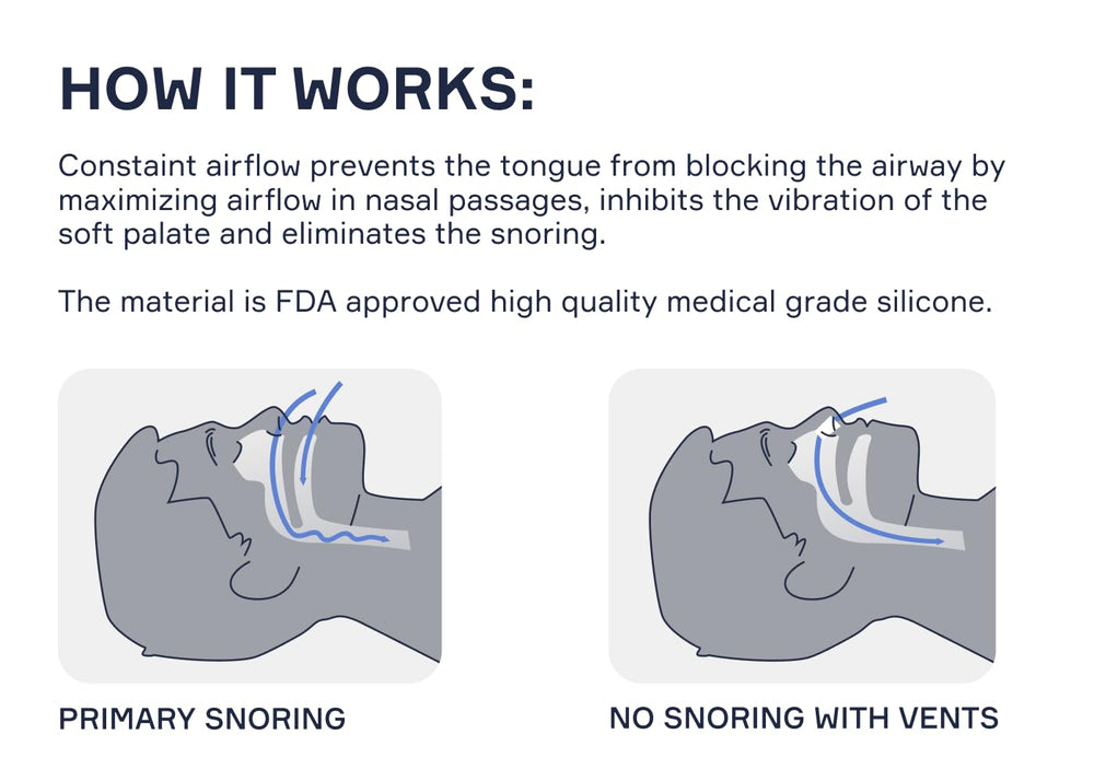 Snore Bastion manos insertando el dilatador con técnica simple