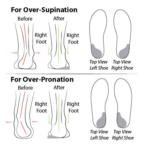 Detalle del gel Soul Insole que muestra textura y amortiguación cómoda