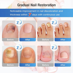 Terquenix empaque abierto con parches listos para uso higiénico