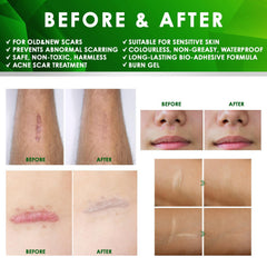 Tobcharm aplicación en oreja con dedo, ilustra uso seguro post-piercing y mejora visible