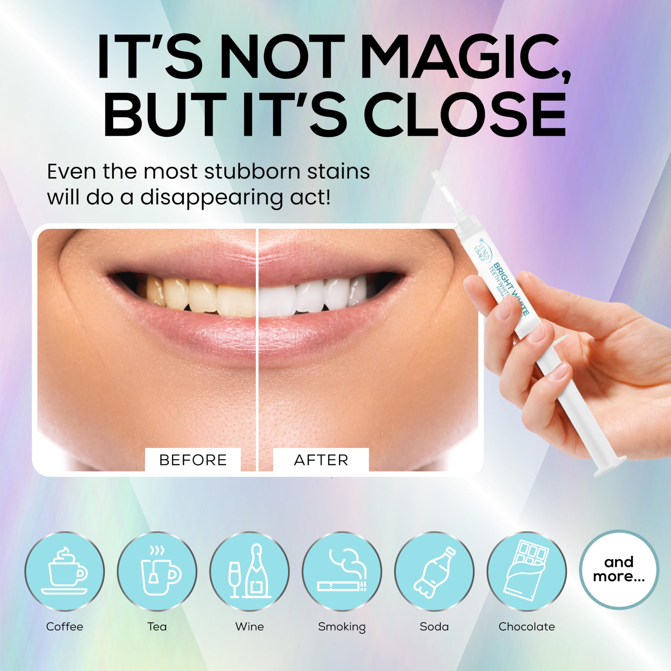 VENUS VISAGE gel en bandeja dental listo para uso para resultados uniformes