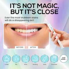 VENUS VISAGE gel en bandeja dental listo para uso para resultados uniformes