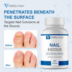 Vitality Now cápsula Nail Exodus en mano para mostrar dosificación y facilidad