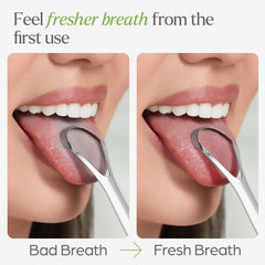 VIVAGO persona usando raspador para mejor higiene bucal