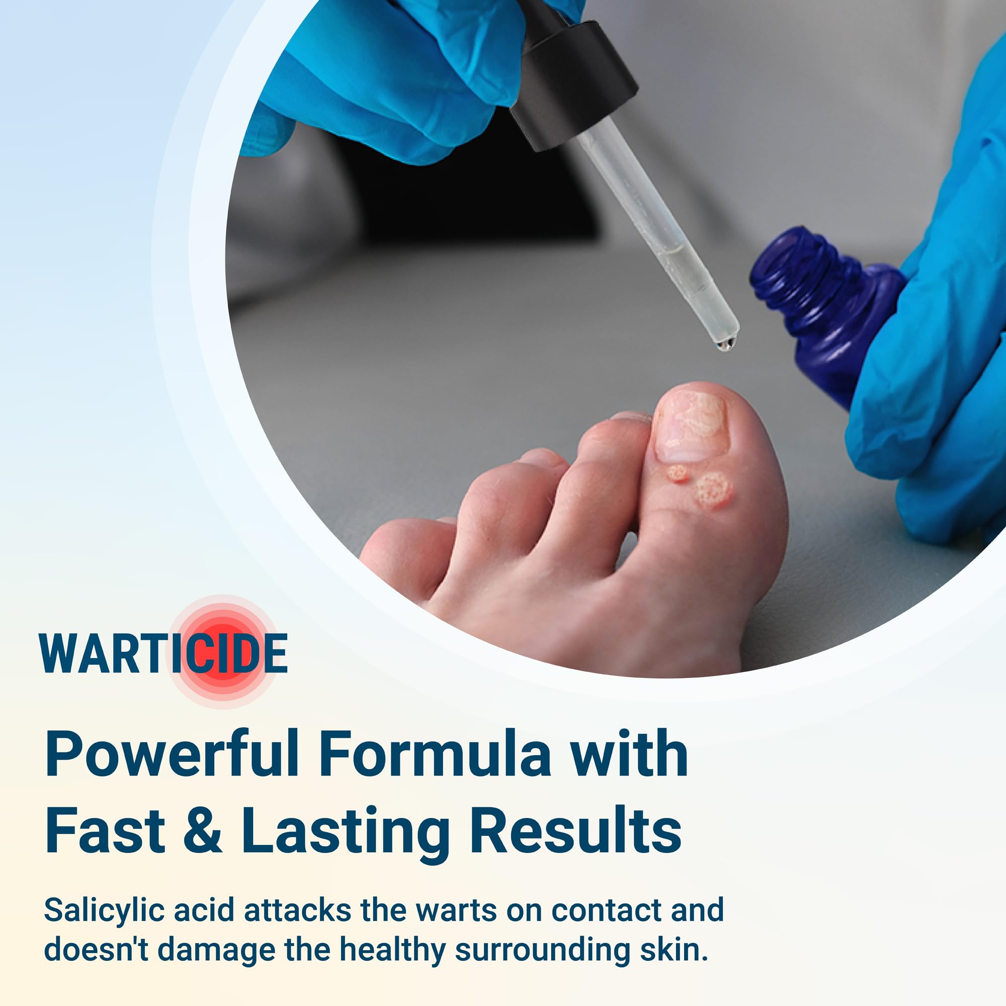 Warticide comparación de tamaño 1 fl oz para visualizar portabilidad y dosis
