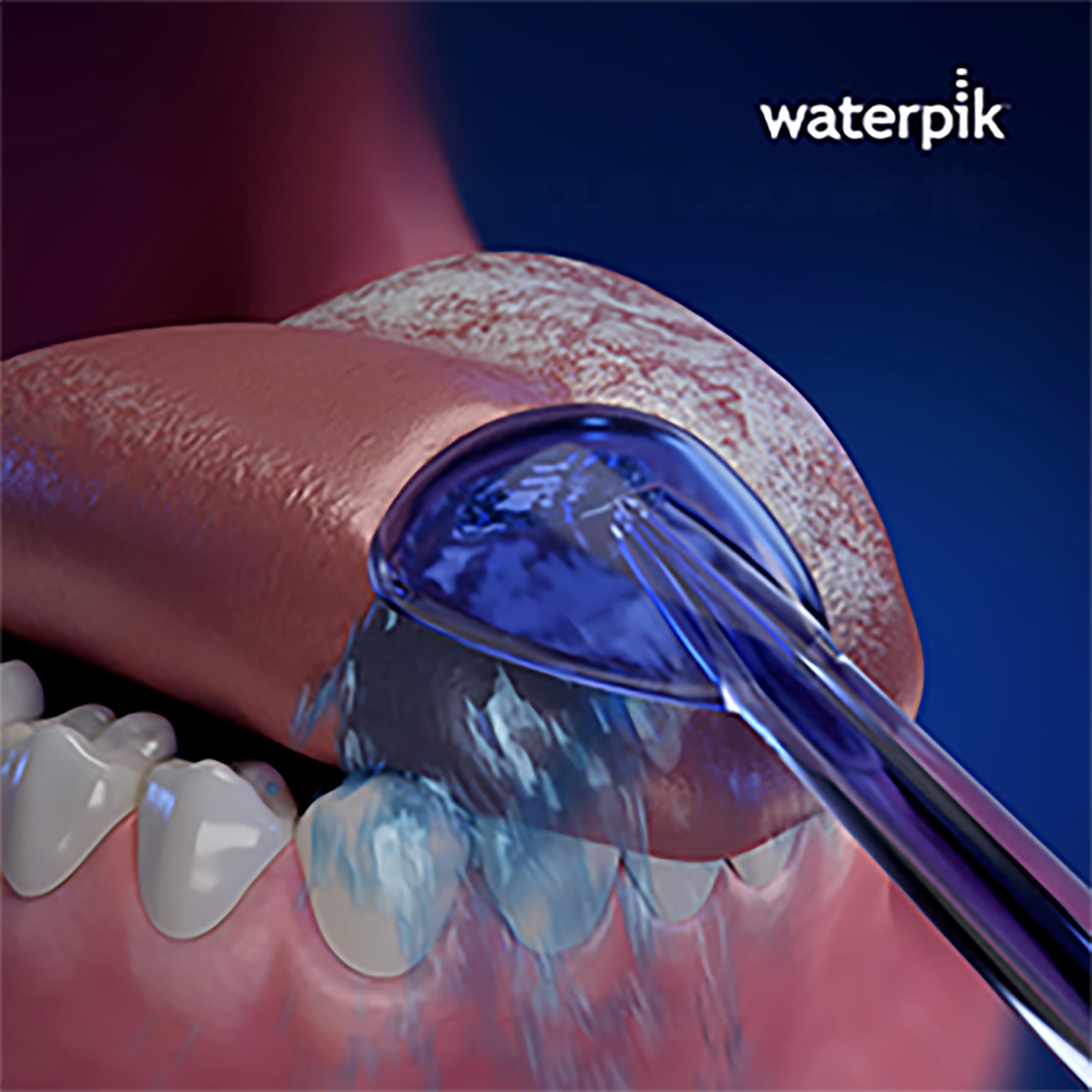 Empaque Waterpik TC-100E con etiqueta y dos puntas codificadas por color