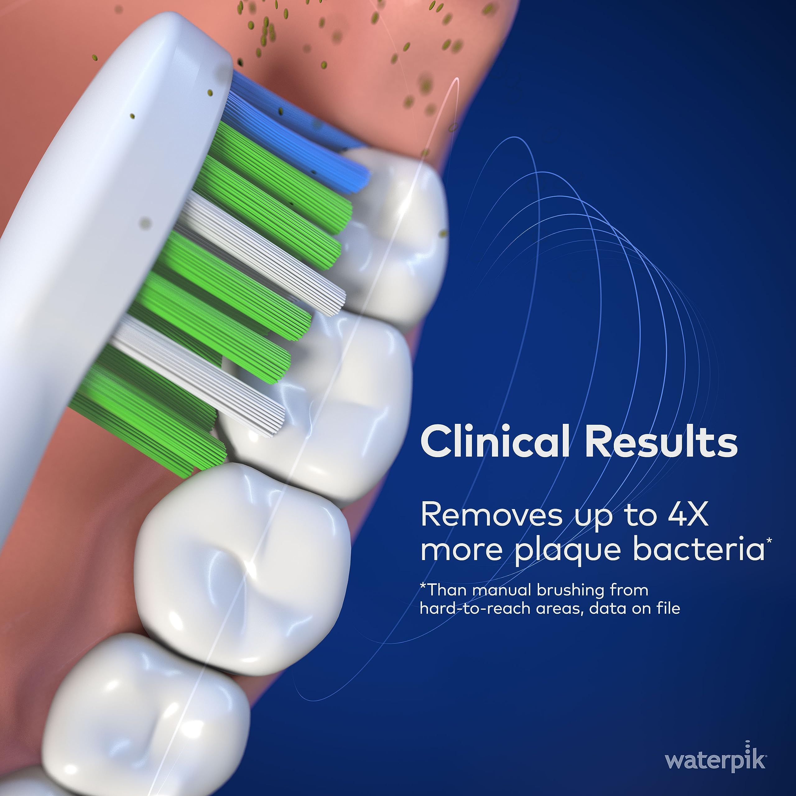 Detalle de cerdas indicadoras Waterpik Sensonic que señalan cuándo reemplazar