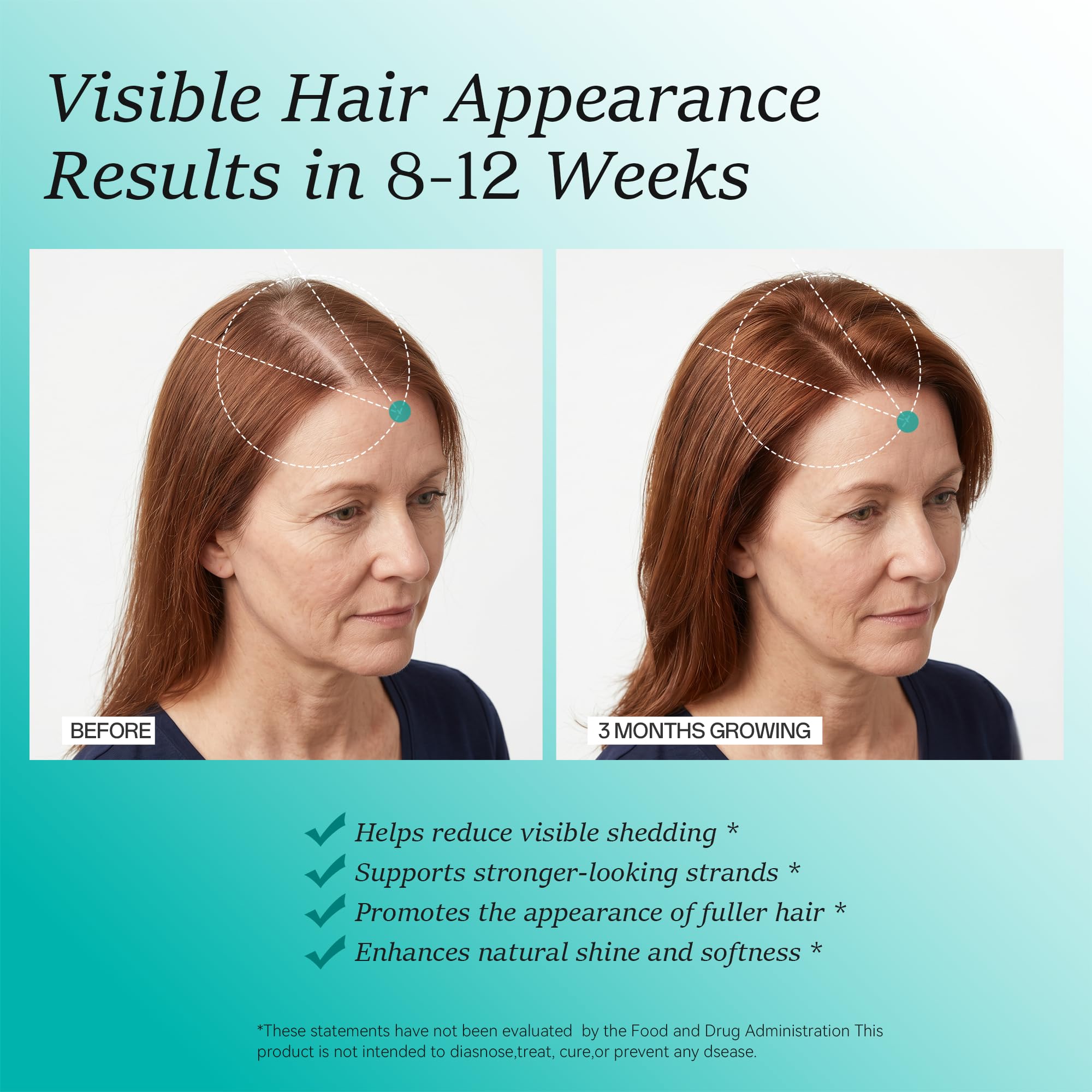 Mujer usando Wiltormin en su rutina matutina para cabello más denso