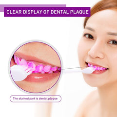Y-Kelin dientes antes y después mostrando reducción visual de placa