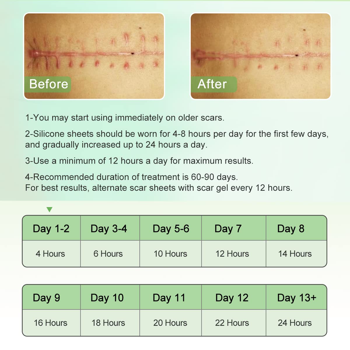 ZODENIS detalle de adhesión pegado sin irritación ni dolor