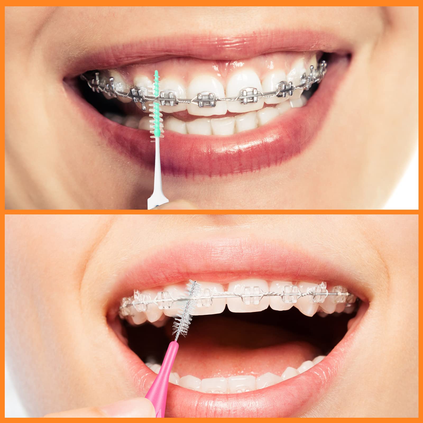 Zopeal set dentro de un bolso ideal para higiene oral en viajes